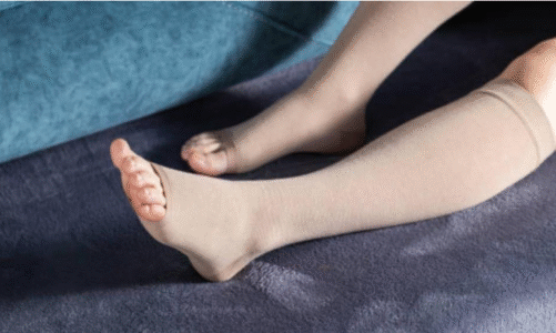 شراب طبي لدعم مرضي الليمفيديما